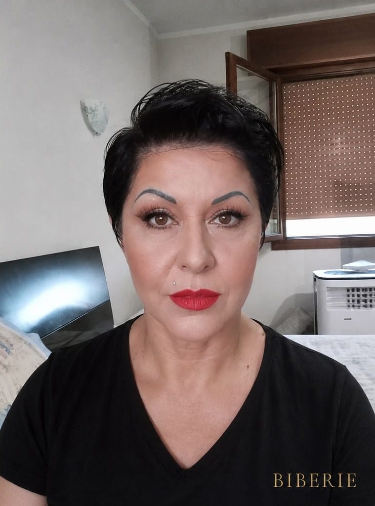 Facelift — natural result