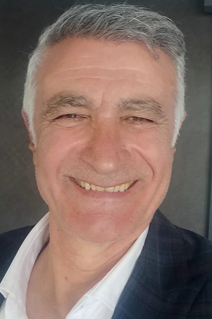 Hair restoration — natural hairline