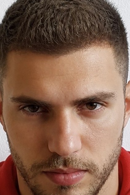Hair restoration — natural hairline